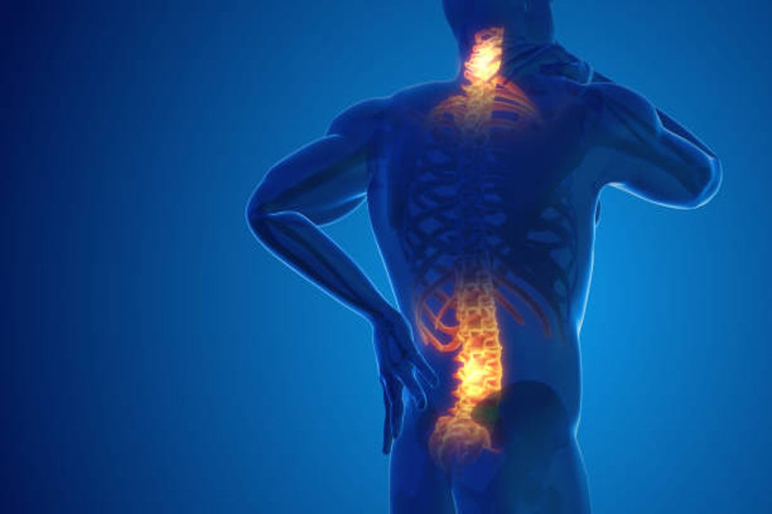 "Nutrition for Back Pain Relief: Foods That Support a Healthy Spine"